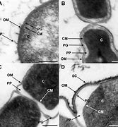 Image result for Tem Bacterial Cell