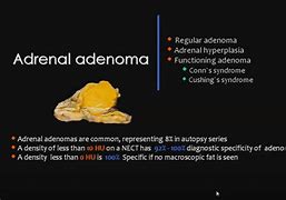 Image result for Adrenal Gland Adenoma