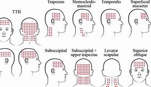 Image result for Head Pressure Points