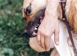 Image result for Dog Bite Injury Pics