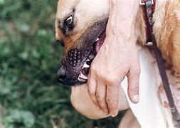 Image result for Dog Bite Blood