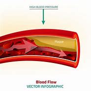 Image result for Blood Pressure Illustration