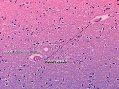 Image result for Brain Tissue Histology