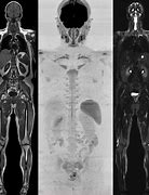 Image result for Whole Body MRI Angio