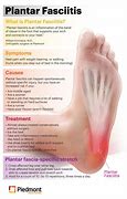 Image result for Heel Pain Plantar Fasciitis Sandals