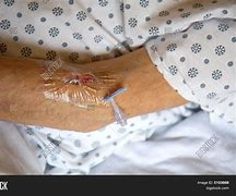 Image result for IV Needle