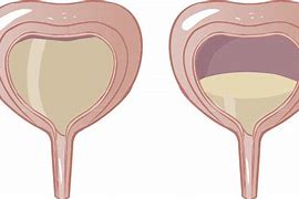 Image result for Botox for Overactive Bladder