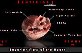 Image result for Pig Heart Labeled