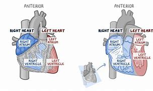 Image result for Interventricular Septum