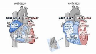 Image result for Myocardium of Interventricular Septum