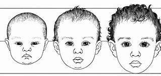 Image result for baby face proportions