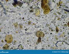 Image result for Fungal Hyphae in Soil