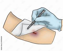 Image result for Wound Care Nurse Clip Art