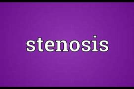 Image result for Stenosis