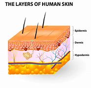 Image result for Dermis Skin Cut