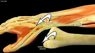 Image result for External Retinaculum