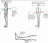 Image result for Mid Coronal Plane