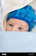 Image result for Cross Eyed Babies