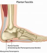 Image result for Barefoot Shoes for Plantar Fasciitis