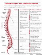 Image result for Spinal Chart Hand Out