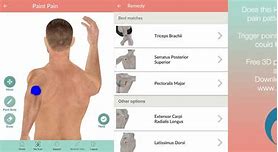 Image result for Outer Elbow Pain