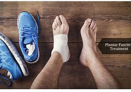 Image result for Severe Plantar Fasciitis