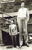 Image result for Example of Gigantism