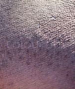 Image result for Hippo Skin Thickness