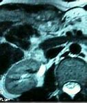 Image result for IRM Abdominal