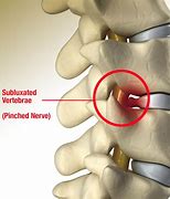 Image result for Pin Nerve Function