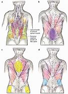 Image result for Back Pain Chart