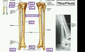 Image result for Which One Is Tibia and Fibula