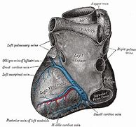 Image result for Posterior Interventricular Sulcus