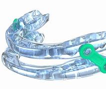 Image result for Obstructive Sleep Apnea Mouthpiece