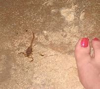 Image result for Scorpion Sting Bite