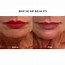 Image result for Chin Correction Filler