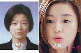 Image result for Jun Ji Hyun Plastic Surgery