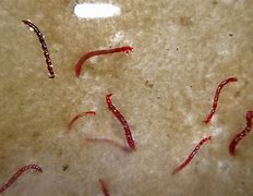 Image result for Bowl of Worms