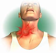 Image result for Red Line On Neck From Necklace