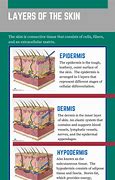 Image result for Dermis Skin Cut