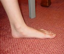 Image result for Flat Feet