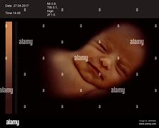 Image result for CT Baby Scan 3D