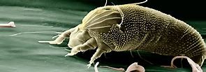 Image result for Fungus Mites