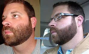 Image result for High Cheek Beard