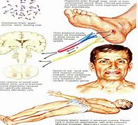 Image result for Tetanus Virus