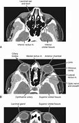 Image result for Orbital Bone Anatomy Model