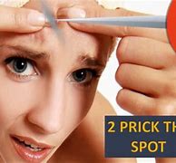 Image result for Pimple Pop