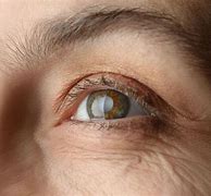 Image result for Narrow Her Eyes