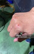 Image result for Women Hands Bleeds