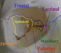 Image result for Bones That Make Orbital Floor